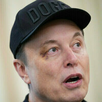 Musk explains his black eye