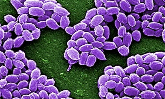 Boy dies, dozens hospitalised in far northern Russian anthrax outbreak Boy dies, dozens hospitalised in far northern Russian anthrax outbreak