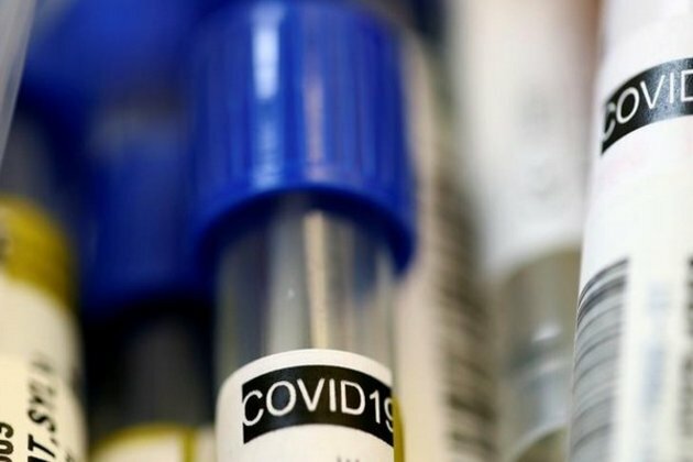 Bolivia's president says she has tested positive for the coronavirus