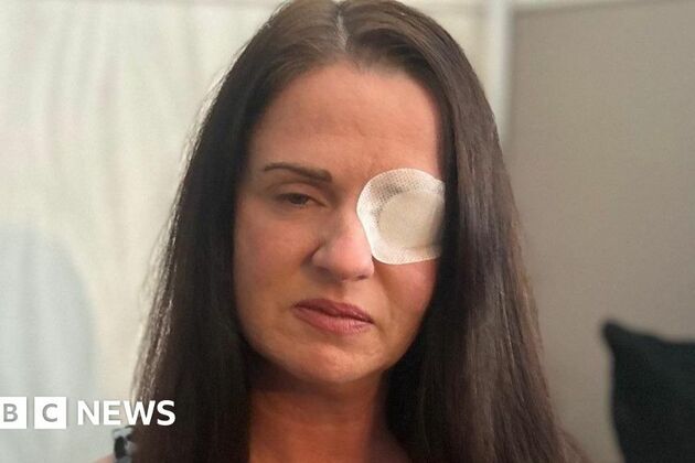 County Durham women fall ill as fake Botox beautician apologises