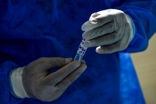 Malawi runs out of coronavirus vaccines as second jabs due