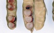  Symptoms of manganese deficiency in narrow-leafed lupin pods. Photo: Nigel Wilhelm