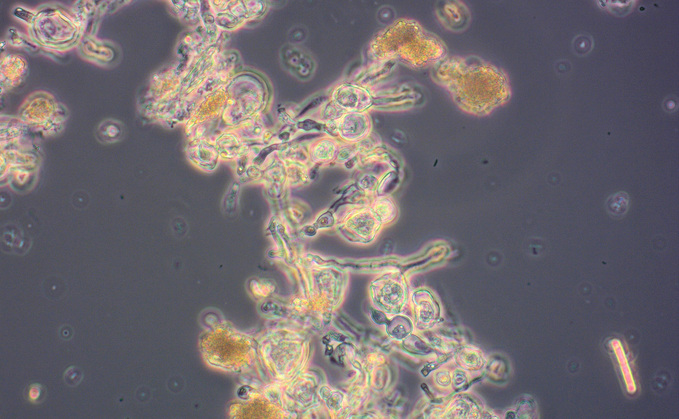 Penicillium fungal cells in a fermentation broth.