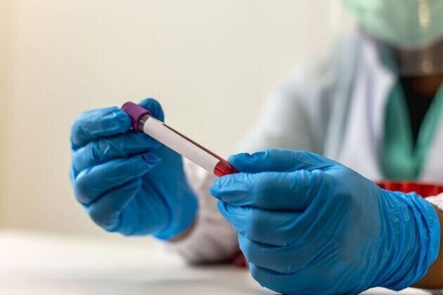 Scientists succeed in synthesising promising anti-cancer fungal compound