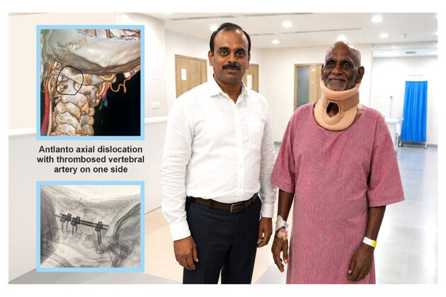 Medicover Hospitals Neurosurgeon Successfully Treats 72-Year-Old with Life-Threatening Cervical Spine Injury