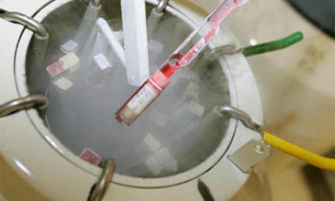 IVF babies healthier than before - study IVF babies healthier than before - study