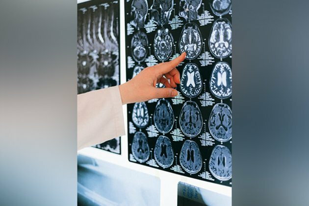 Study reveals role for cell 'antennae' in managing dopamine signals in brain
