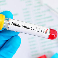No need for panic over Nipah virus  Indian doctor