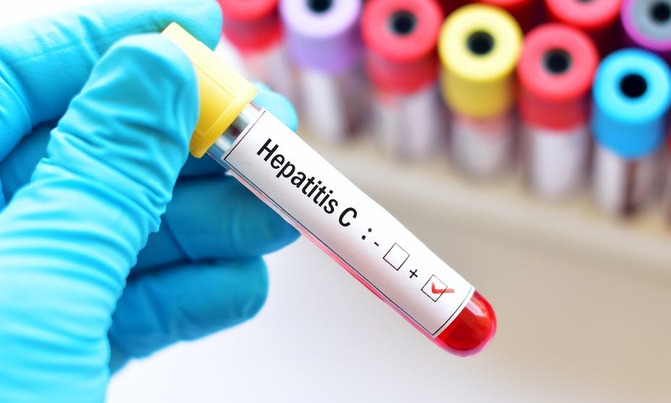 Hepatitis disease: What you need to know about the types Hepatitis disease: What you need to know about the types