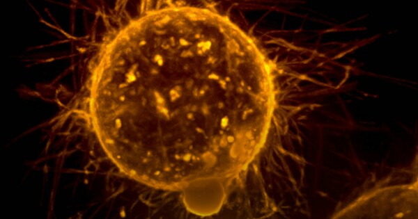 Blood test helps reduce late-stage cancer diagnosis