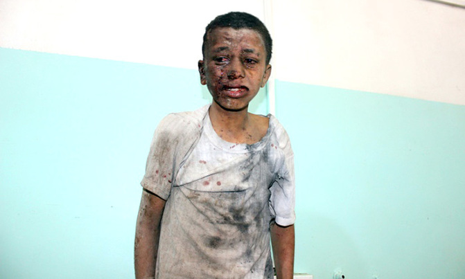 40 children killed in Yemen bus strike 40 children killed in Yemen bus strike