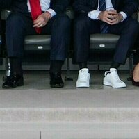 White House explains Trumps swollen ankles and bruised hand