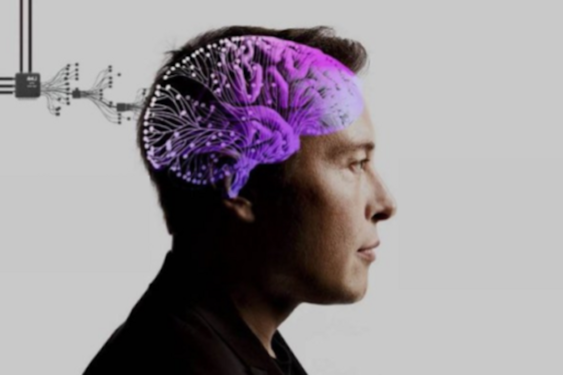 Neuralink to test brain implant in UK for spinal injury patients