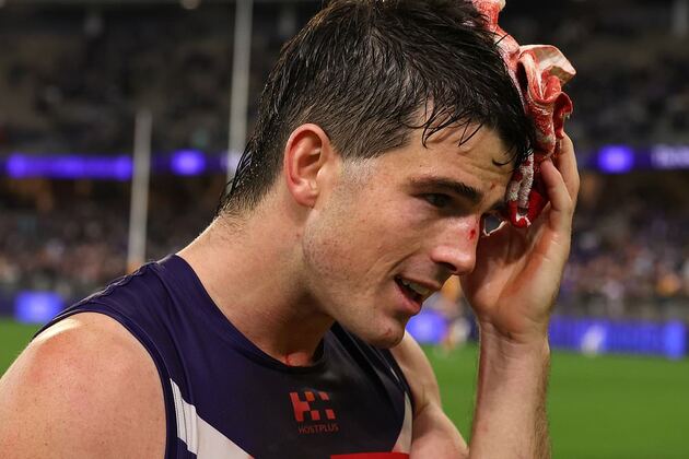 Footy fans stunned by AFL star&#39;s post-game interview after suffering shocking injury