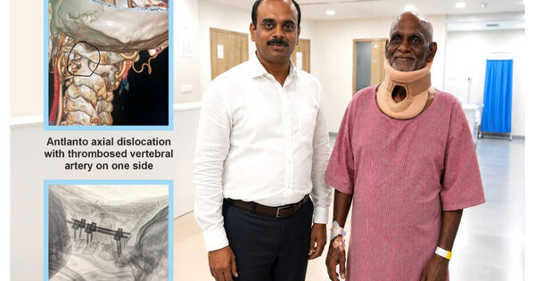 Medicover Hospitals Neurosurgeon Successfully Treats 72-Year-Old with Life-Threatening Cervical Spine Injury