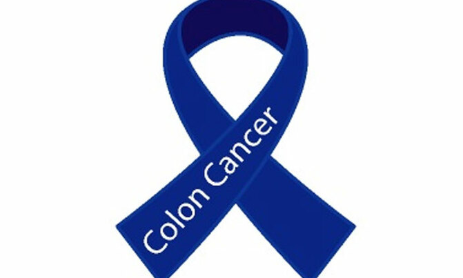 All you need to know about colon cancer All you need to know about colon cancer