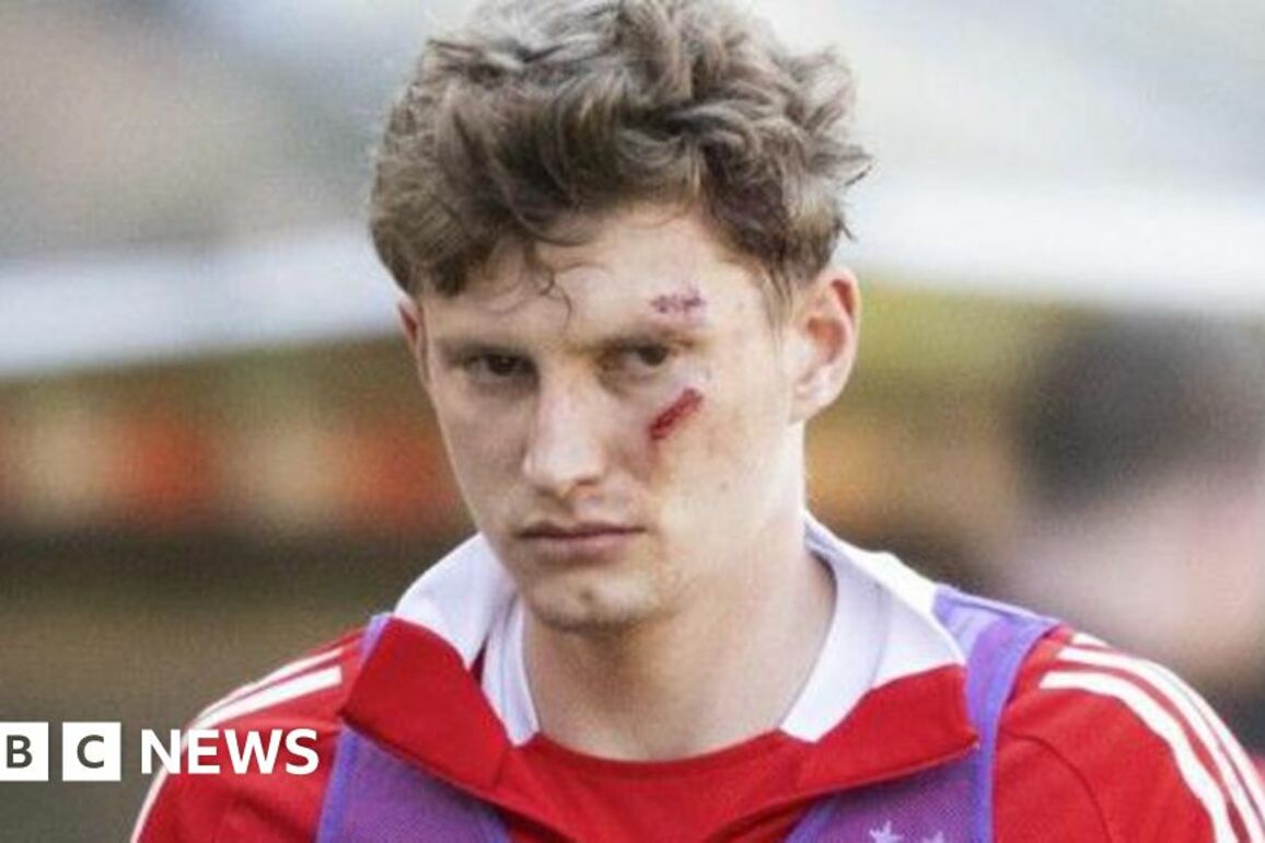 Man charged after footballer struck on head by seat at game