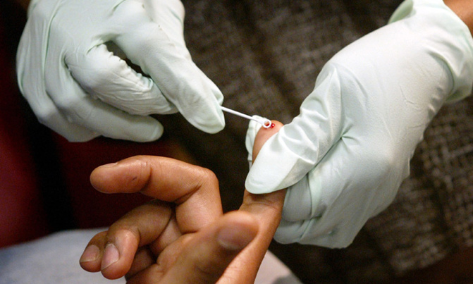 Test can detect HIV within a week of infection: researchers Test can detect HIV within a week of infection: researchers