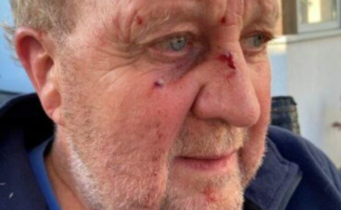 Patrick Atherton said he felt 'powerless' after being attacked by cows in Devon (HSE)