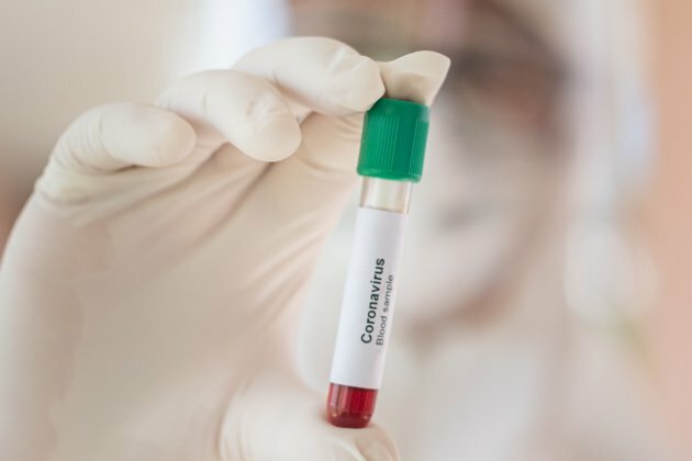 Covid-19: Western Cape contributes 32% of new cases