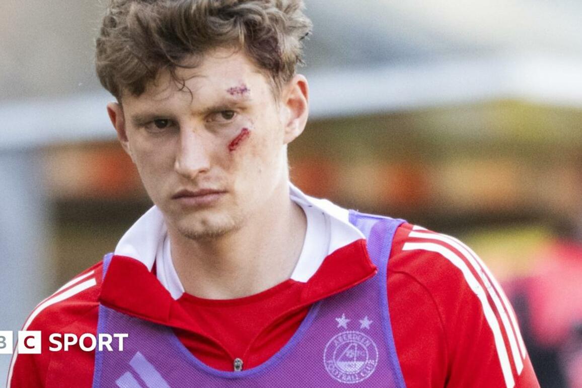 Police still hunt MacKenzie seat throw perpetrator