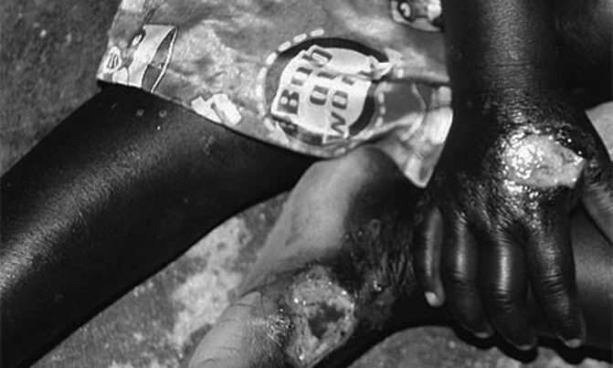 EU, NGOs unite against child abuse EU, NGOs unite against child abuse