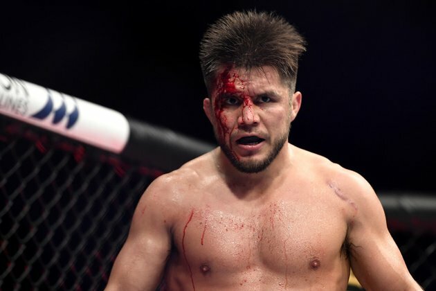 American UFC loudmouth wants to fight ugly potato rival in Russia