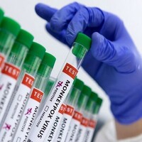 Ghana reported 45 confirmed cases of monkeypox in past month