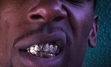 Homem usando grillz 