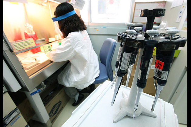 AIDS goal 'more off-track' after U.S. cuts, says UNAIDS chief
