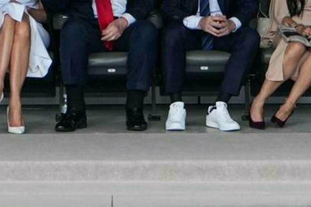 White House explains Trump's swollen ankles and bruised hand