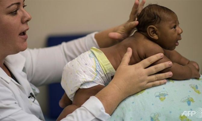 Children with 'normal' heads may have Zika brain damage: study Children with 'normal' heads may have Zika brain damage: study