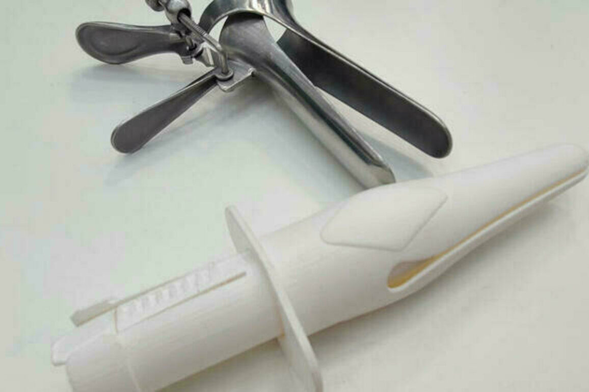 Netherlands researchers redesign vaginal speculum to ease discomfort