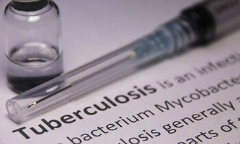 Tuberculosis tb 350x210