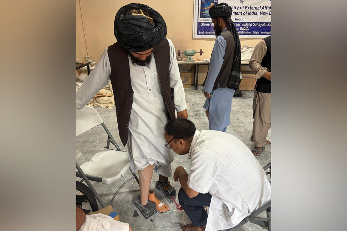 India hosts 'Jaipur Foot' camp in Kabul to aid Afghan amputees