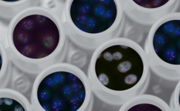 Japan biotech start-up raises $31m Series C
