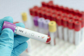 Funding cuts threaten HIV response efforts in South Africa