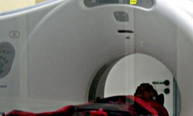 CT scan, other tests equally effective for heart patients CT scan, other tests equally effective for heart patients