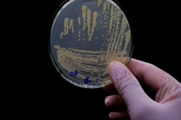 New research reveals relationship between oral bacteria and diseases