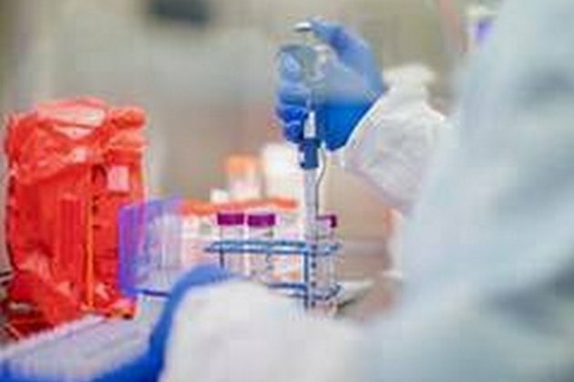 Ukraine's coronavirus count reaches 72,168