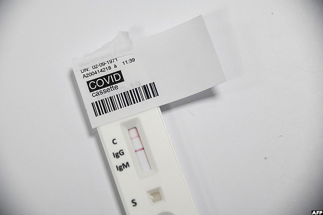   positive 19 serological test is pictured at a laboratory in olmar eastern rance