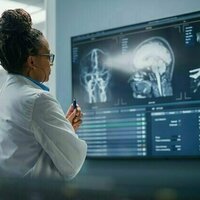 Brains of people with schizophrenia may age faster - how our research adds to the evidence