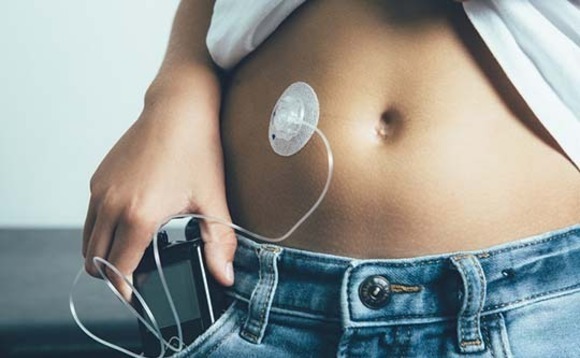 PE-backed MicroTech Medical targets $254m Hong Kong IPO