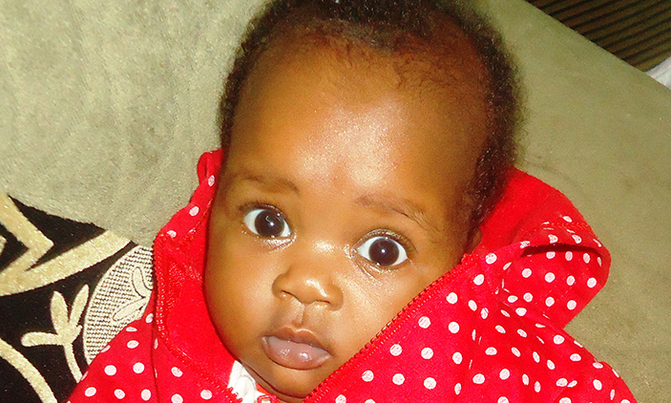 A fontanel speaks volumes about your child's health A fontanel speaks volumes about your child's health