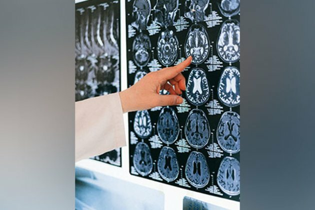 Study reveals how brains turn into smarter disease fighters