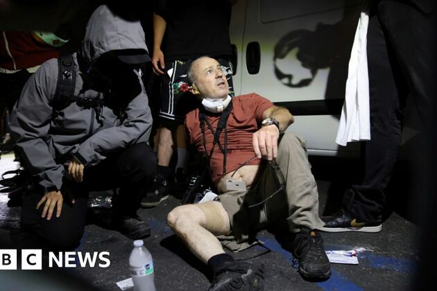 British photographer injured by &#39;plastic bullet&#39; during LA protests
