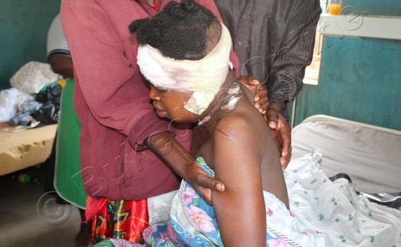 Brenda Nairuba ng’apooca mu ddwaaliro ly’e Kamuli-Mulago. Brenda Nairuba ng’apooca mu ddwaaliro ly’e Kamuli-Mulago.