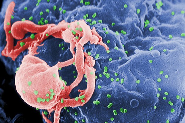 The parallels of fighting the Aids epidemic and Covid-19 pandemic