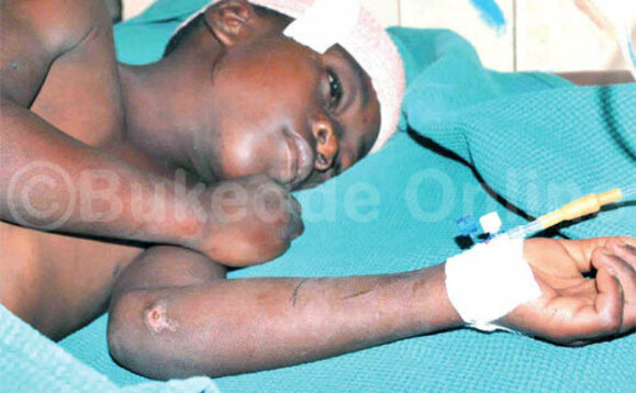 Mukisa yakoseddwa nnyo ku mutwe. Mukisa yakoseddwa nnyo ku mutwe.