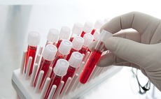 IHH leads $20m round for Singapore science ministry spin-out